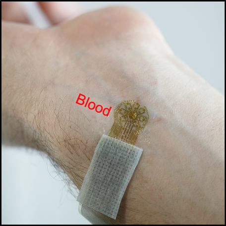 Researchers have developed an ultra-thin, wearable epidermal sensing device that resembles a temporary tattoo that measures vascular and tissue health by mapping blood flow. The device provides physicians with information that advances wound care and treatment of a wide range of diseases. (Source: R. Chad Webb, Department of Materials Science and Engineering, University of Illinois at Urbana-Champaign)