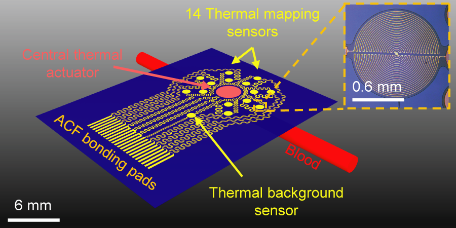 The epidermal sensing device combines a thermal actuator and a radial array of 14 temperature sensors made of ultra-thin layers of gold, chromium, and copper, providing the flexibility required to allow the device to comfortably conform to the surface of the skin. (Source: R. Chad Webb, Department of Materials Science and Engineering, University of Illinois at Urbana-Champaign)
