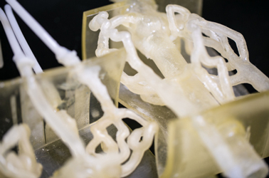 Stratasys 3D-Printed replica of the brain aneurysm helped The Jacobs Institute correct Flint’s condition. Image Credit: Business Wire