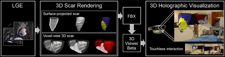 A framework for holographic visualization of the 3D late gadolinium enhancement data. Source: Jang et al.