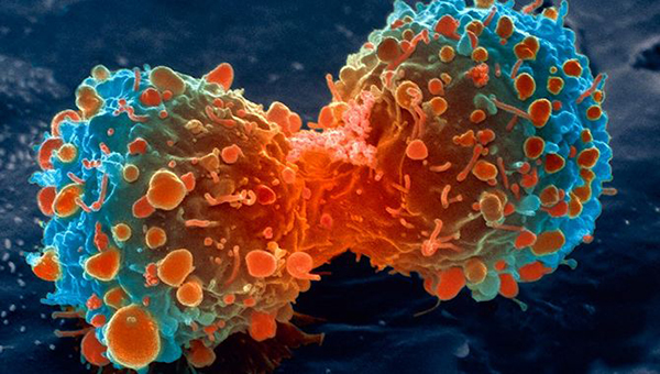 Cancer cell during division. Source: National Institutes of Health
