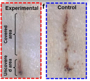 Digital image of wound recovery after two days in both experimental (red rectangle) and control (blue rectangle) rat model groups. Source: University of Wisconsin-Madison