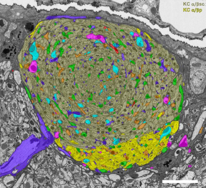 A reconstruction of neurons in the adult fly mushroom body — including Kenyon cells (yellow), mushroom body output neurons (purple) and dopaminergic neurons (green) — highlights unexpected connections. Source: Takemura et al./eLife 2017
