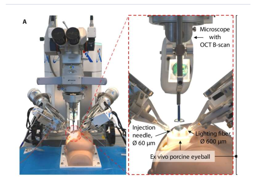 Graphical abstract of the autonomous retinal vein cannulation workflow. Source: Adapted from Zhang et al., Science Robotics (2025).