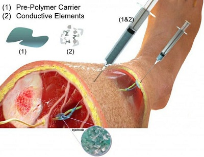 The researchers are testing a scheme in which they inject the fluid around the nerve, then extrude a thin insulated string of the material back to just underneath the surface of the skin, where they inject more of the composite material. Source: Neuronoff Inc.