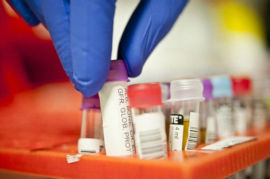 New sensor technology could reduce the need for multiple blood tests. Source: University of York 