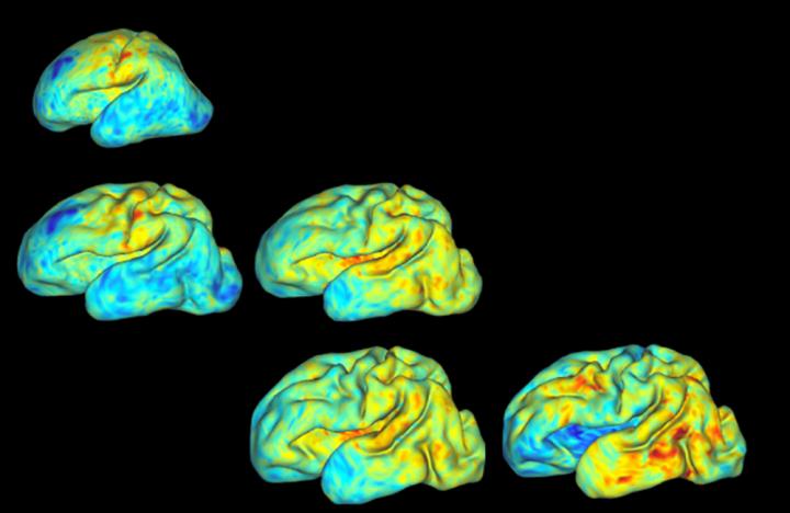 The 3D mapped brain of a third trimester baby. (Source: Washington University in St. Louis)