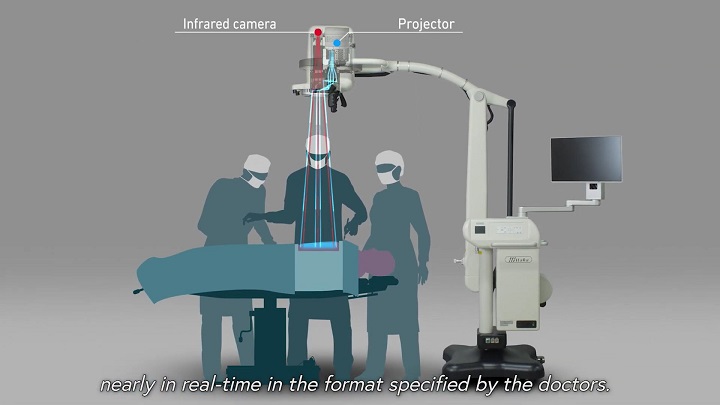 MIPS projects images directly onto the patient as a guide for surgeons during complex operations. Source: Panasonic