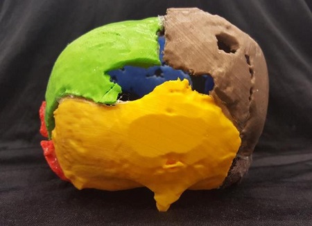 Gorm the Old's 3D-printed cranium, seen from behind. Note the "bird's beak" protrusion at bottom. Source: A 3D print of bones from Gorm the Old; Source: Marie Louise Jørkov