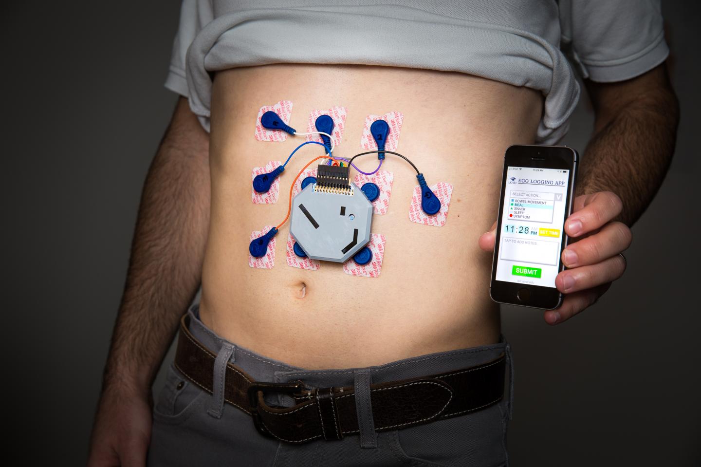 Researchers have developed a wearable system to monitor stomach activity that performs as well as current state of the art methods but can be used outside of a clinical setting.  (Source: University of California San Diego)