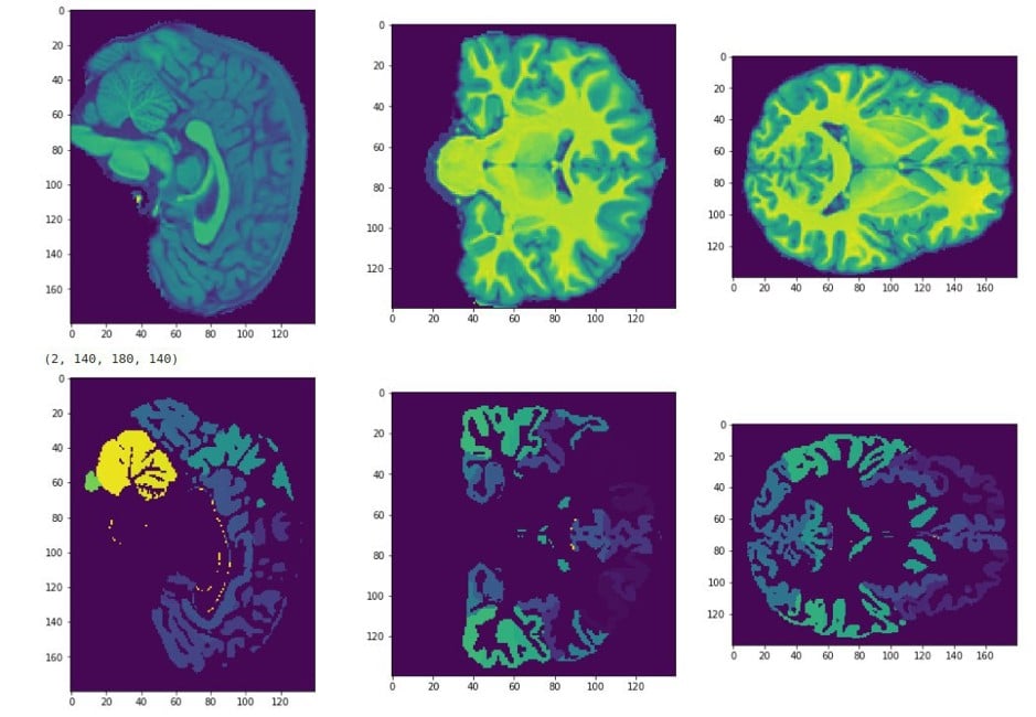 In this study, the team applied ensembles of classifiers to 3D of super precision neural networks. Source: Skoltech Communications/Ekaterina Kondratyeva