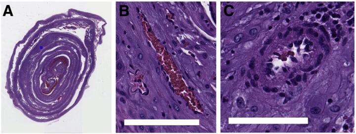 A digitized whole slide image of a placental membrane roll [low magnification; haemotoxylin and eosin (H&E) stain]. To illustrate relative scale, the blue square indicates a single blood vessel. Source: College of Engineering, Carnegie Mellon University