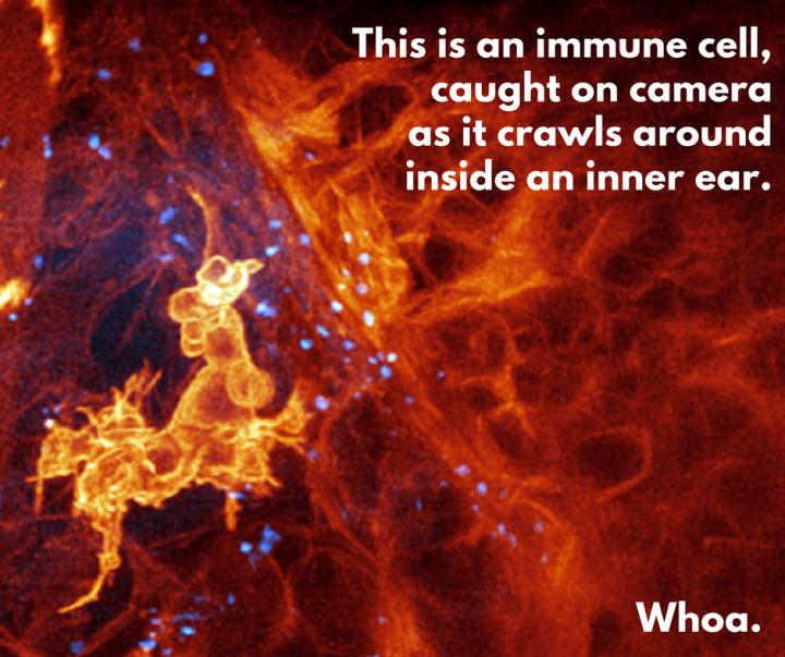 An immune cell crawls around the inner ear of a zebrafish. (Source: Boston Children's Hospital)