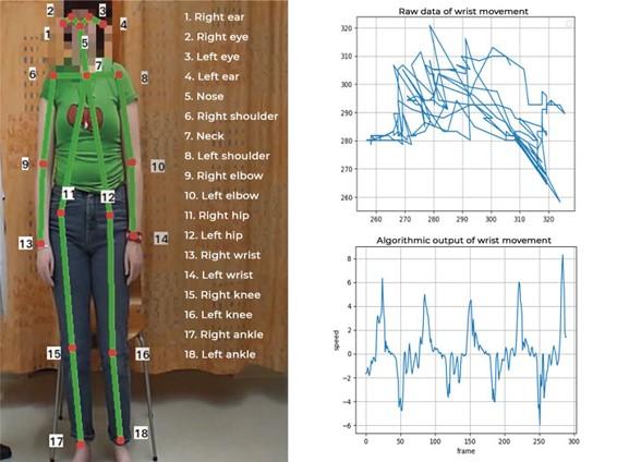 Predefined keypoints and raw data and algorithmic output of wrist movement. Source: Neuro Event Labs