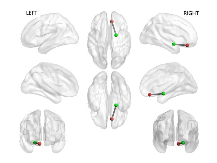 Researchers used mobile sensing data to predict brain connectivity between the ventromedial prefrontal cortex (red) and right amygdala (green). Source: Jeremy Huckins