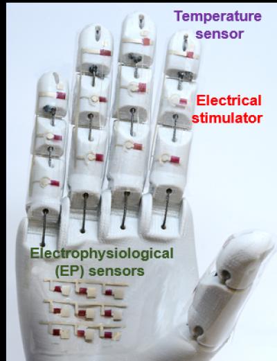 A medical robotic hand is just one potential application for the rubbery electronics reported by researchers. Source: University of Houston