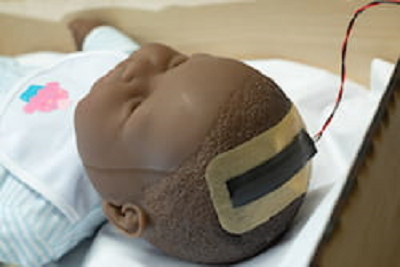 The system monitors high ICP within the skulls of infants, a condition that affects more than 400,000 every year. Source: Jeff Fitlow/Rice University