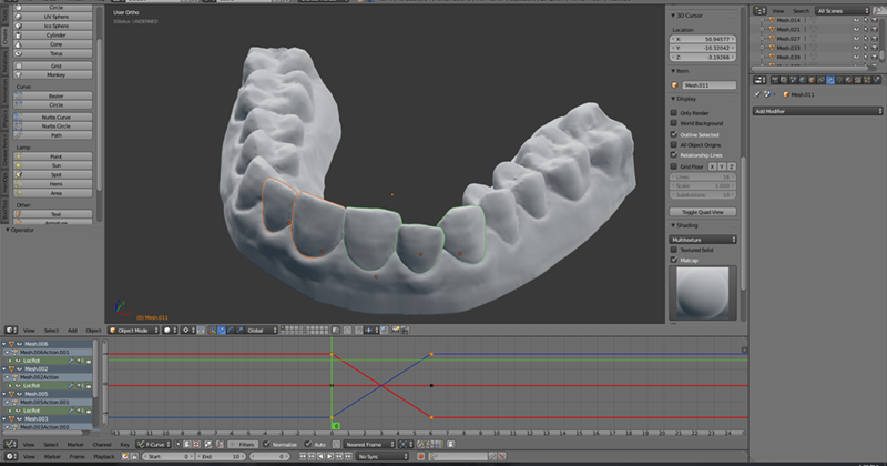 College student Amos Dudley does not recommend creating your own dental aligners, but that did not stop him from doing it using 3-D printing technology.  