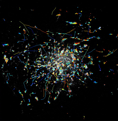 The rapid movements of Rab11 particles can be clearly imaged with the new instant TIRF-SIM microscope. Source: Hari Shroff/ NIBIB