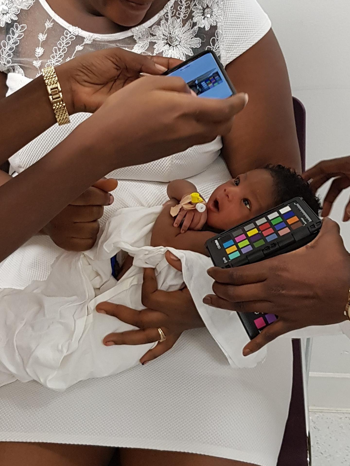 The screening method is currently being trialled in a large-scale feasibility study at Greater Accra Regional Hospital. Source: Dr Christabel Enweronu-Laryea, University of Ghana