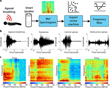 Using a smart speaker to detect agonal breathing. a) Agonal breathing detection pipeline, b) audio waveform and c) spectrogram of agonal breathing, hypopnea, central apnea and obstructive apnea. Source: University of Washington