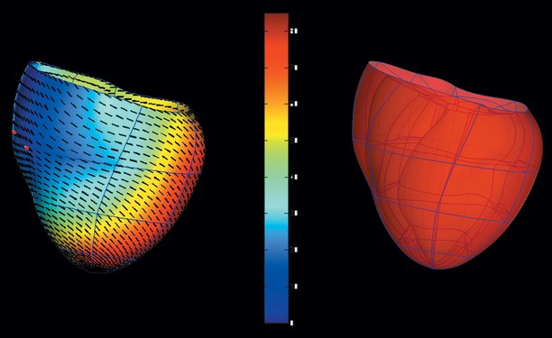 Figure 2: The virtual hearts. Source: Johns Hopkins University