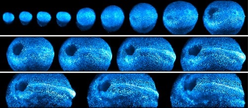 A new light sheet microscope gives scientists a window into mouse development. Source: K. McDole et al./Cell 2018